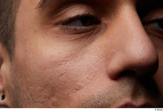 HD Face Skin Shawn Jacobs cheek eye face nose skin…